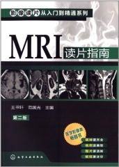 MRI 读片指南（第二版）